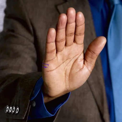 Треугольник в конце линии брака говорит о давлении со стороны супруги, а остров посередине второй отметки — о драматичных событиях в семье знаки на линии брака