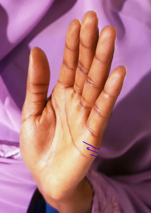 Супружескую линию у женщин рассматривают как показатель количества возможностей вступить в брак или же иметь длительные отношения супружеская линия у женщин